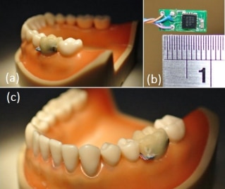 In-tooth sensors Image of in-tooth sensors