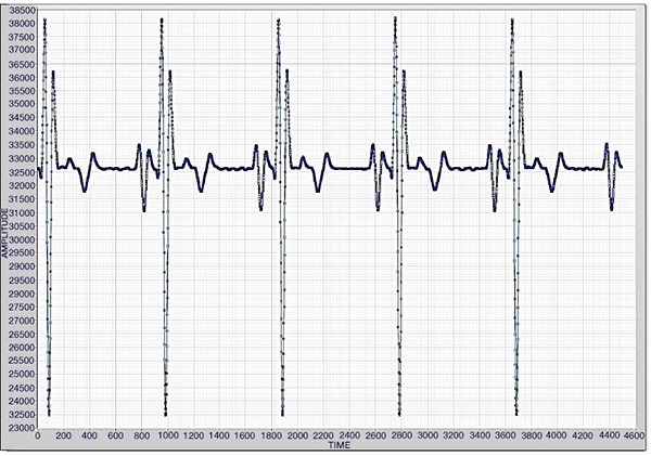 ECG generator set at 60 BPM Image of ECG generator set at 60 BPM