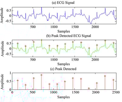 Ongoing signal and the peaks from an EKG to measure the heartbeat parameters Image of ongoing signal and the peaks from an EKG to measure the heartbeat parameters
