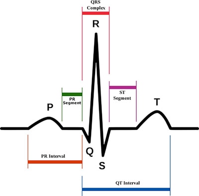 ECGs provide extensive information about cardiac health Graph of ECGs provide extensive information about cardiac health