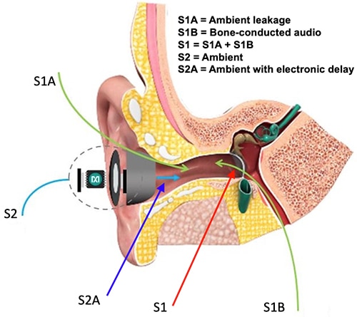 Sources of sound reach the eardrum with a PSAP Schema delle fonti di suono che raggiungono il timpano con un PSAP