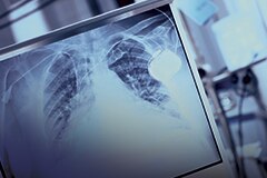 Solutions for Medical Applications