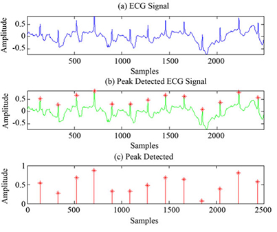 Image of ongoing signal and the peaks from an EKG to measure the heartbeat parameters