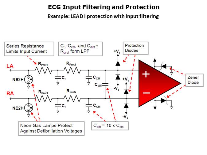 Medical ECG Slide 12