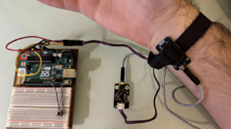 Image of Low-Cost, Power Efficient EMG Prosthetic Hand (Part 1)